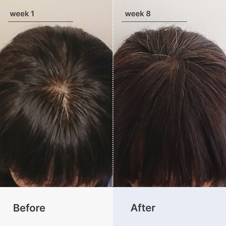 Superpower+ Advanced Hair & Scalp Duo