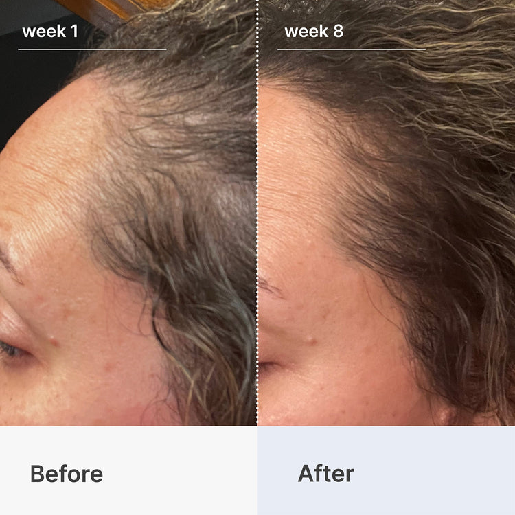 Superpower+ Advanced Hair & Scalp Duo