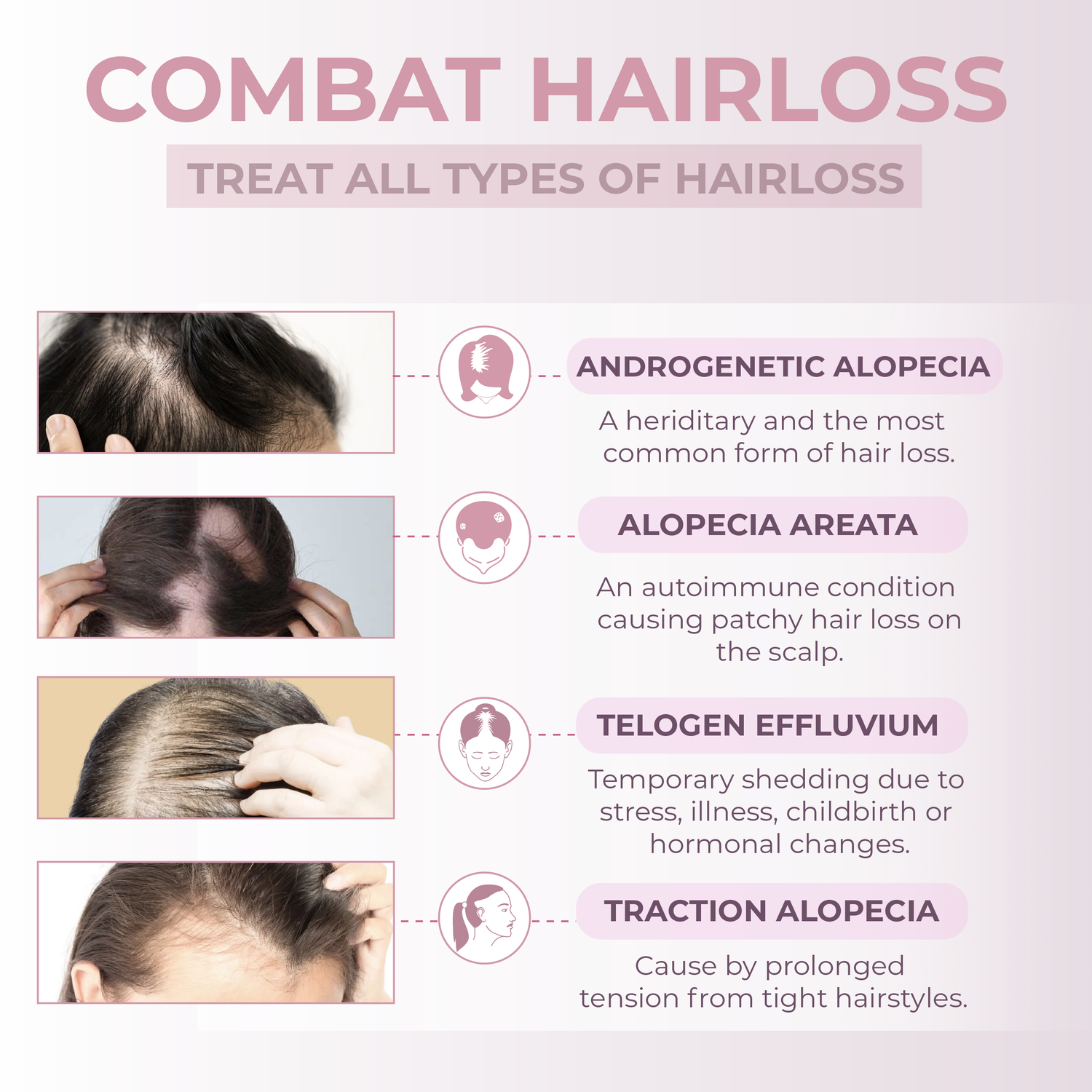 Educational graphic about different types of hair loss with images and descriptions.