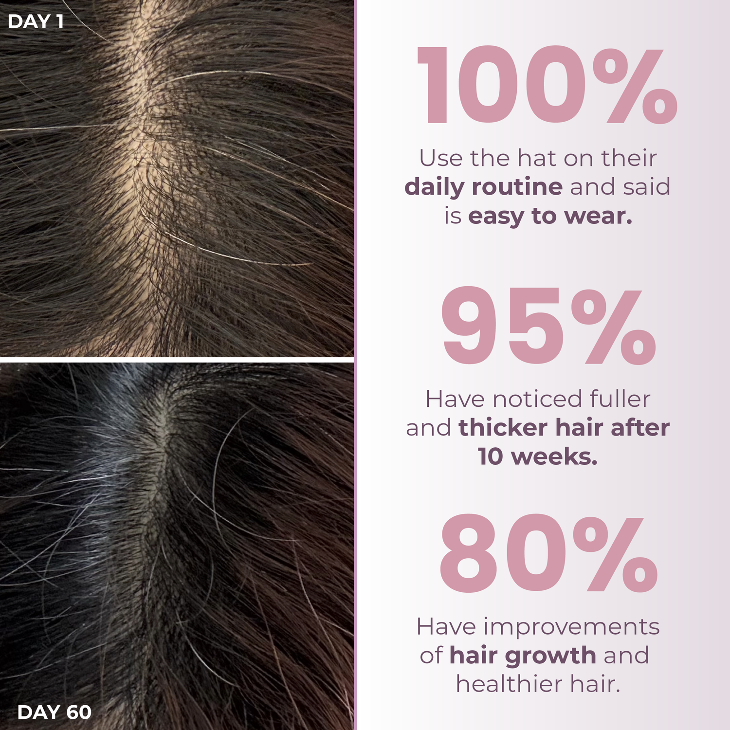 Before and after hair growth comparison with statistics on a white background