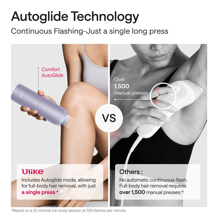 Advertisement comparing Ulike hair removal device with other options using Autoglide Technology.