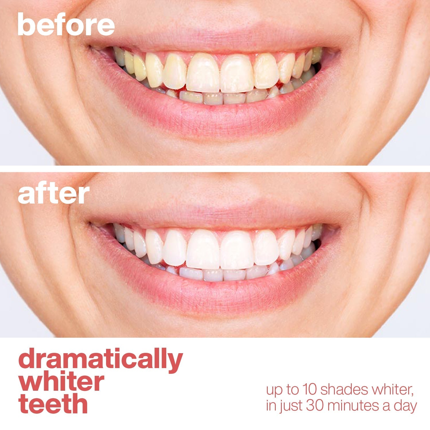 Before and after comparison of teeth whitening with text indicating improvement.