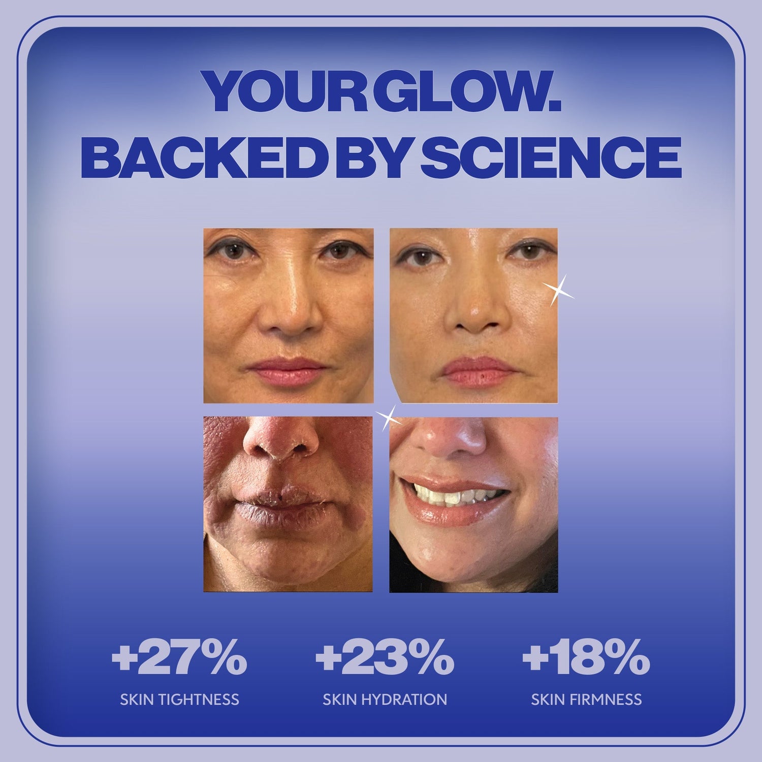 Before and after skin comparison with text 'Your Glow. Backed by Science' on a blue background.